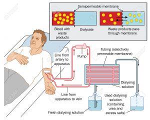 KidneyImg